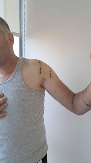 Babası gibi ayı saldırısına uğradı; parmağı koptu