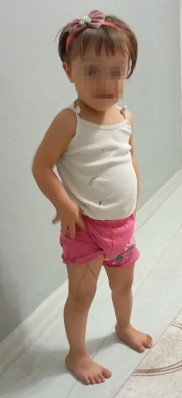 Çocukları Down sendromlu doğan ailenin ara buluculukta 700 bin TL talebi reddedilen davada, 77 milyon TL tazminat kararı