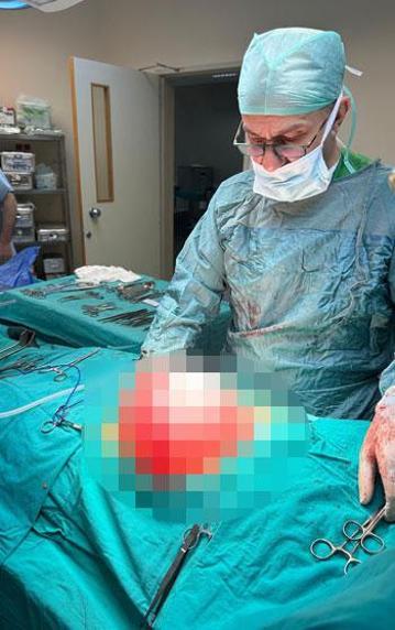 Kilolarından kurtulmak için doktora giden liseli kızın karnından 3,5 kilo ağırlığında kist çıktı