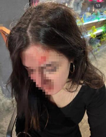 Ceren’in, eski sevgilisinin kız arkadaşı tarafından darbedildiği anların görüntüsü ortaya çıktı