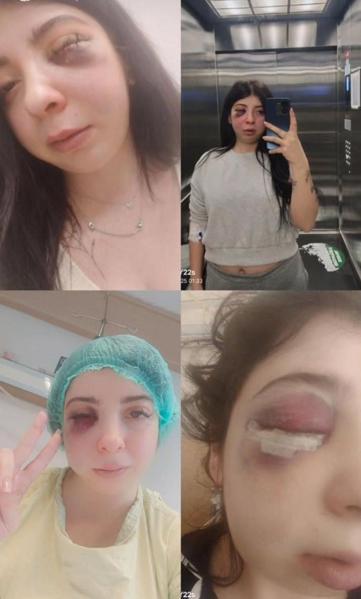 Damlayı sokakta darbeden sanığa 3 yıl 8 ay hapis