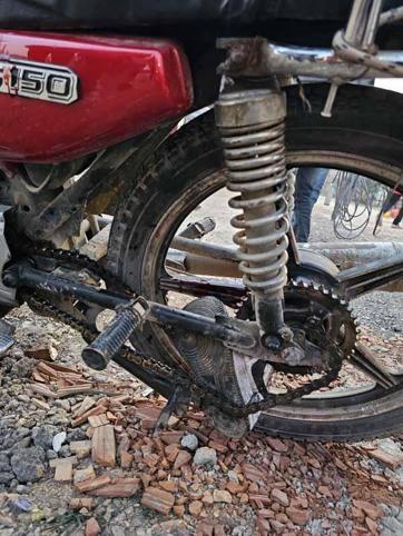 Motosikletin zincirine ayağı sıkışan çocuk, yaralandı