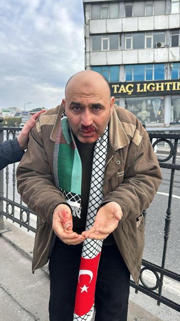 Filistine destek yürüyüşündeki vatandaşa yumruklu saldırı: Şüpheli gözaltına alındı