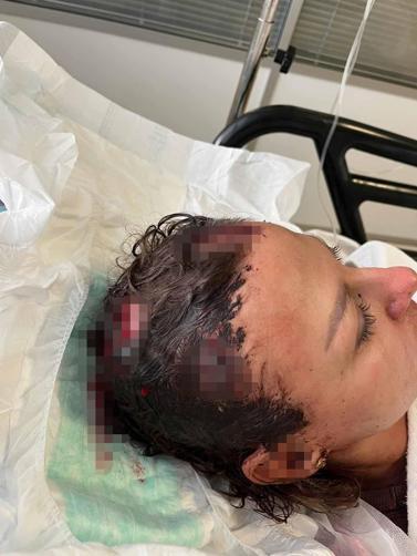 Eşinin darbettiği Iryna: Duruşmada yüz yüze gelince kendimi güvensiz hissettim