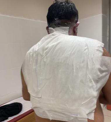 Soğuk havayı test etmek isterken kendini yaktı