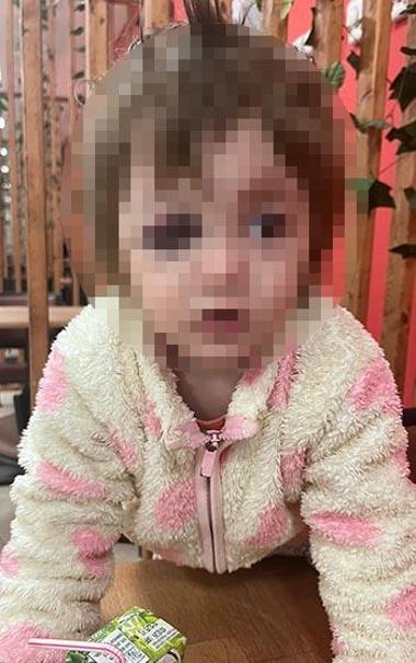 İkra ile babasının darbedilmesine ilişkin iddianame hazırlandı; çocuk skuterı silah olarak sayıldı