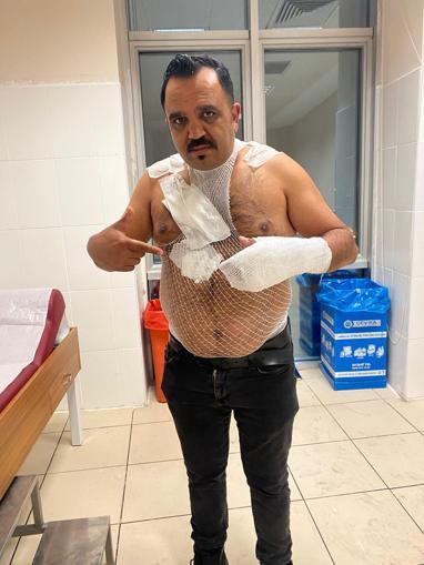 Soğuk havayı test etmek isterken kendini yaktı