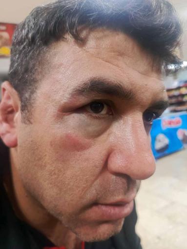 Konyada amatör ligde kavga: 5 yaralı