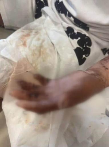 Kağıthane’de kuafördeki yangında tüm vücudu yanan 14 yaşındaki Enginin tedavisi tamamlandı: Kapı sıkışınca çıkamadım yandım