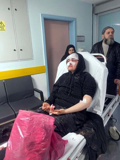 Boşanma aşamasındaki eşini kaldırım taşıyla ağır yaralayan şüpheli tutuklandı