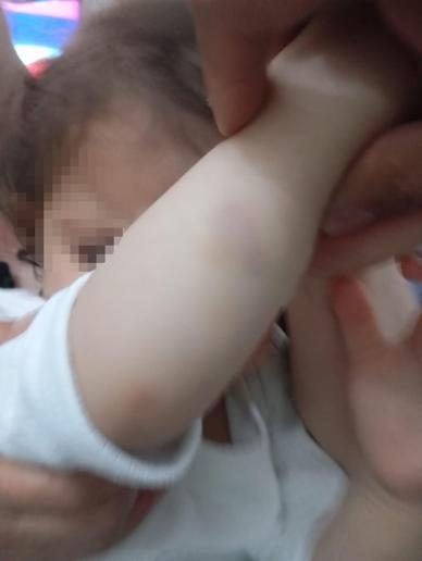 1,5 yaşındaki kızını dövdüğü iddia edilen anneye 2 yıla kadar hapis talebi