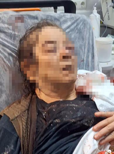 Evde otururken tavandan kopan moloz yığını altında kalan kadın yaralandı