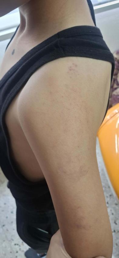 Babasının darbettiği 12 yaşındaki çocuk koruma altına alındı