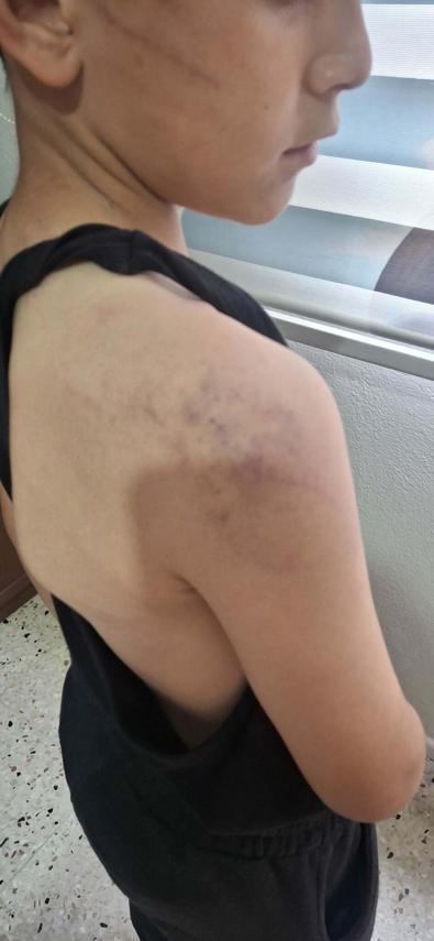 Babasının darbettiği 12 yaşındaki çocuk koruma altına alındı