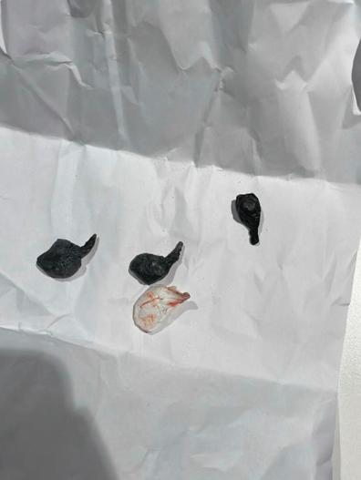 Eğlence mekanları ve otellere uyuşturucu operasyonu: 17 gözaltı