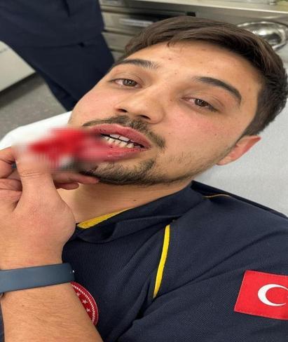 Yolunu kestiği paramedik ambulans şoförünü darbeden sanık, 54 gün sonra tahliye edildi