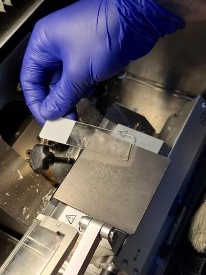 Egenin tek kas ve sinir biyopsisi yapılan hastanesiyiz