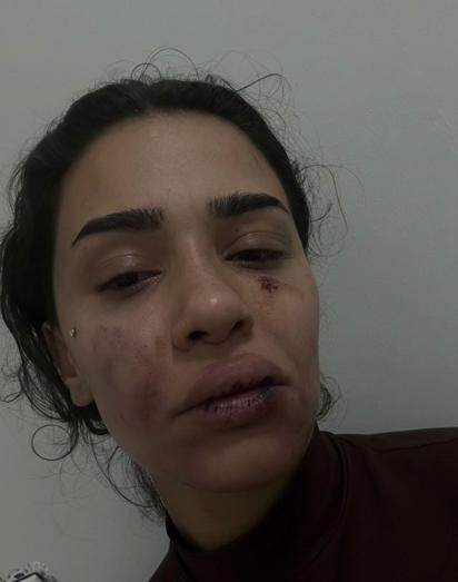 Bahçeşehirde uzaklaştırma kararına rağmen evinin önünde darbedilen Ebru: Ölmeden önce sesimi duyun