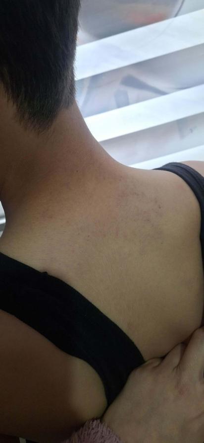 Babasının darbettiği 12 yaşındaki çocuk koruma altına alındı