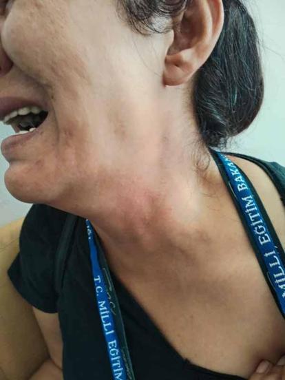 Öğretmene tokat atan veli tutuklandı; saldırı kamerada