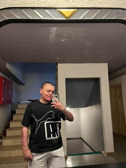 Kağıthane’de kuafördeki yangında tüm vücudu yanan 14 yaşındaki Enginin tedavisi tamamlandı: Kapı sıkışınca çıkamadım yandım