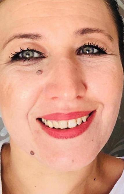 İki yıl her yediğini kusan hastanın operasyon sonrası taze fasulye mutluluğu