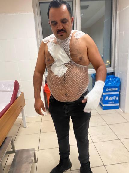 Soğuk havayı test etmek isterken kendini yaktı