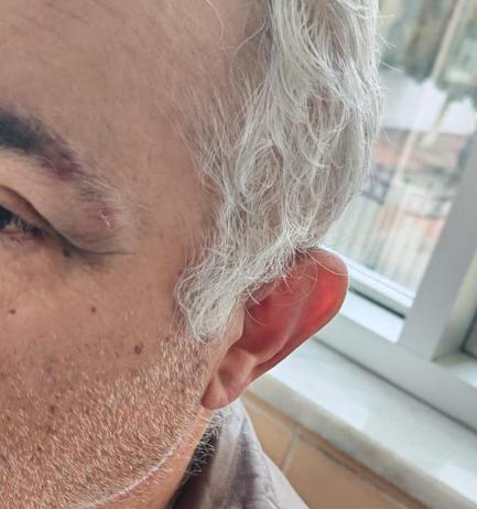 Aile hekimini darbeden müezzin, savcılığın itirazıyla yeniden gözaltına alınıp tutuklandı