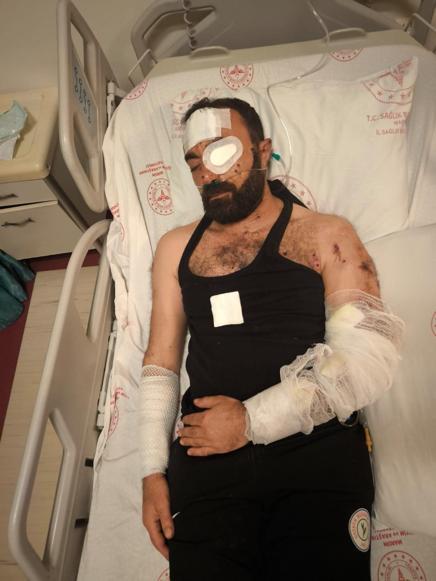 Silahlı kavgada yaralanan dernek başkanı: Daha önce kuzenimi öldürüp, beni bıçakladılar