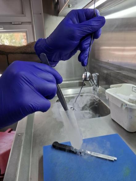 Egenin tek kas ve sinir biyopsisi yapılan hastanesiyiz