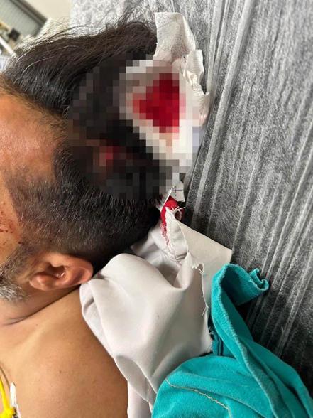Başına mermi isabet eden döner ustası: Ölebilirdim, suçlu bulunsun