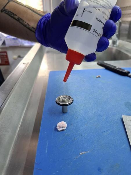 Egenin tek kas ve sinir biyopsisi yapılan hastanesiyiz