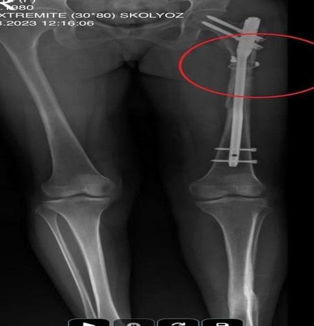 Arkadaşını öldürüp, yaraladığı sevgilisini 21 gün boyunca evinde tutan sanık için müebbet istemi