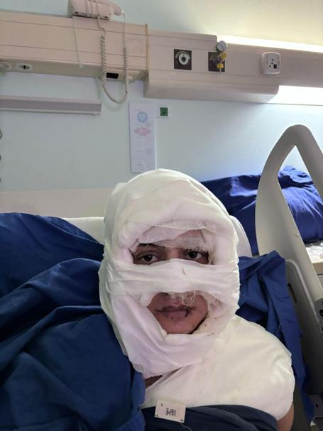 Kadıköyde bir kadın, üzerine yanıcı madde dökülerek ateşe verildi