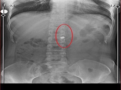 Arkadaşını öldürüp, yaraladığı sevgilisini 21 gün boyunca evinde tutan sanık için müebbet istemi