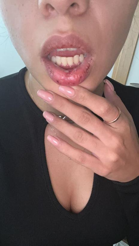 Taksi şoförü aracına çarptığı Azerbaycanlı sanatçıyı darbetti