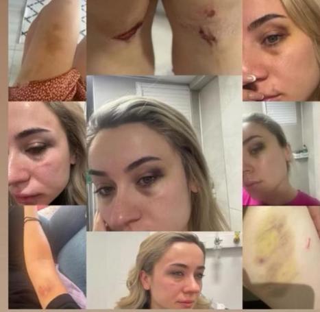 Sanal medyadan şiddet gördüğünü paylaşan öğretmenin eski eşine tekme- tokat dayak