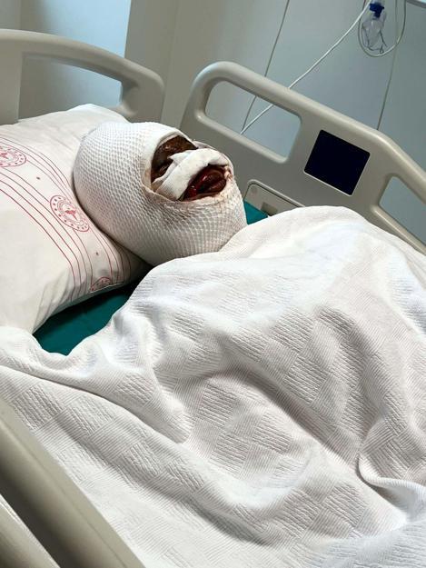 Boşanma aşamasındaki eşini koli bandı ile bağlayıp, başından aşağı kezzap döktü