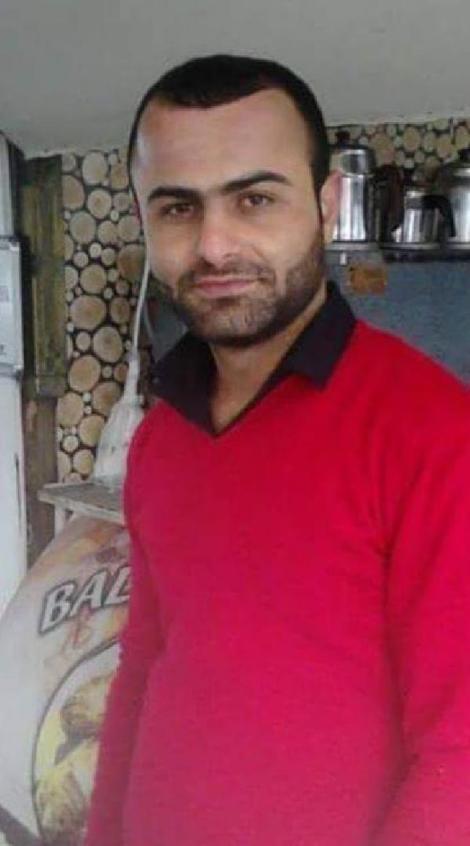 Lazer epilasyon sonrası yanık suçlaması