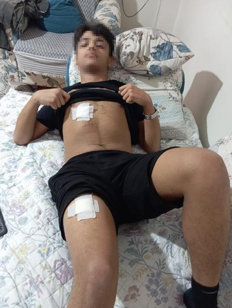 Eski sevgilisiyle yazıştığı akranı ve onun arkadaşları tarafından dövülüp, bıçaklandı