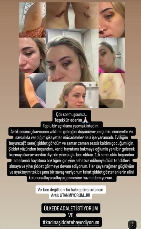 Sanal medyadan şiddet gördüğünü paylaşan öğretmenin eski eşine tekme- tokat dayak