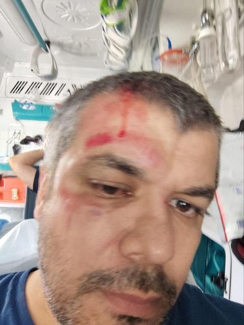 Esenyurtta sinyal verme kavgasında yumrukla saldırdığı sürücüyü bayıltıp kaçtı