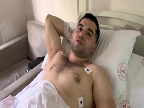 Video uğruna üst geçidin altından geçmeye çalışırken düşüp 2 bacağını kırdı