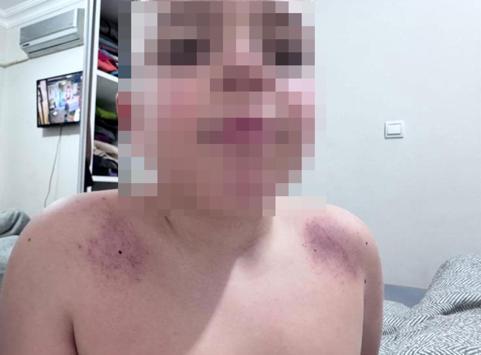 Oğlunu darbettiğini iddia ettiği öğretmenden şikayetçi oldu