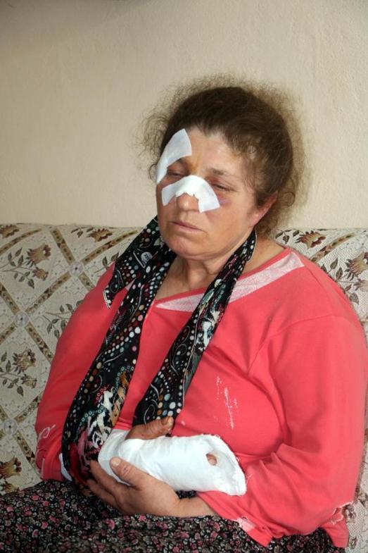 Husumetli olduğu akrabası baba-oğulun baltalı saldırısında yaralandı