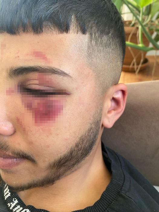 Yolunu kestikleri Yağızı öldüresiye dövüp, 4 yerinden bıçakladılar; o anlar kamerada