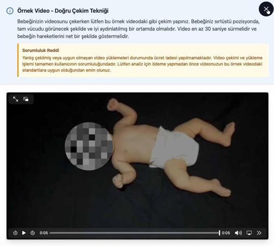 Serebral palsi ve SMA hastalıklarına erken teşhise yapay zeka teknolojisi