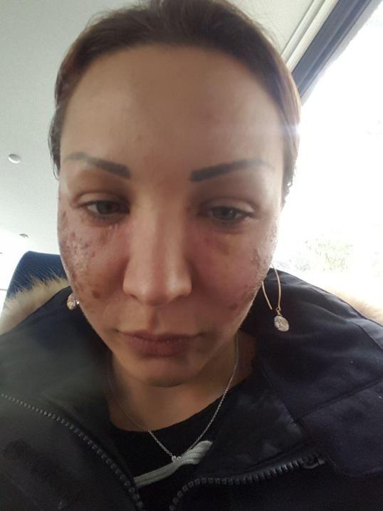 Bulgar modelin estetik kabusu; kuaför kardeşler: Örümcek ağı yapmadık, iftira