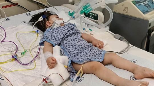 Minik Alper’in anestezi sonrası kalbi durdu, entübe edildi; aile suç duyurusunda bulundu