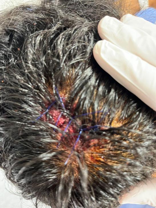 Bahçelievlerde alev alınca balkondan atılan tüp sürücünün kafasına düştü